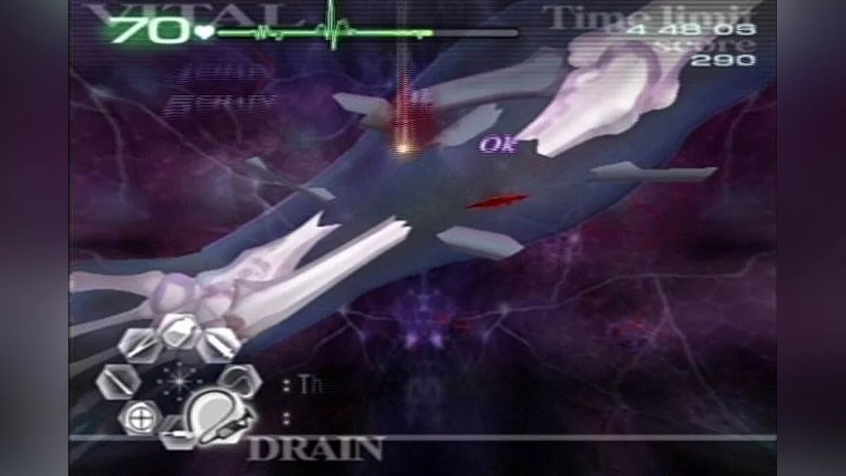 Скриншоты из Trauma Center: Second Opinion / Картинка 39