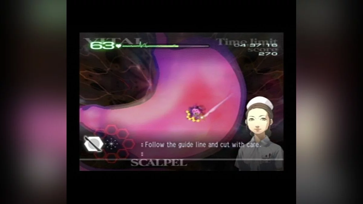 Скриншоты из Trauma Center: Second Opinion / Картинка 30